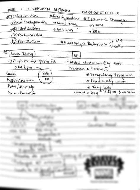 SOLUTION Ekg Part2 Common Abnormalities Studypool