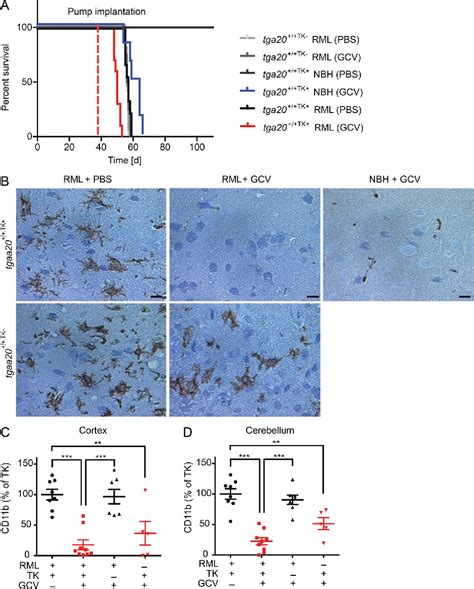 Figure 2 From A Neuroprotective Role For Microglia In Prion Diseases