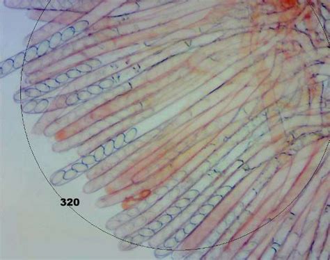 Peziza Under Microscope Labeled