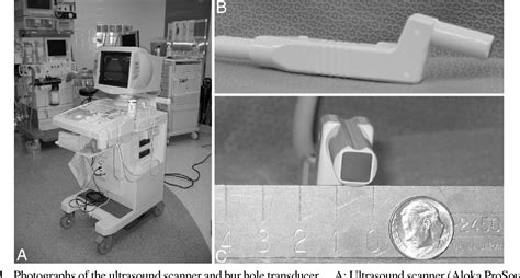 Figure 1 From Accurate Placement Of Cerebrospinal Fluid Shunt