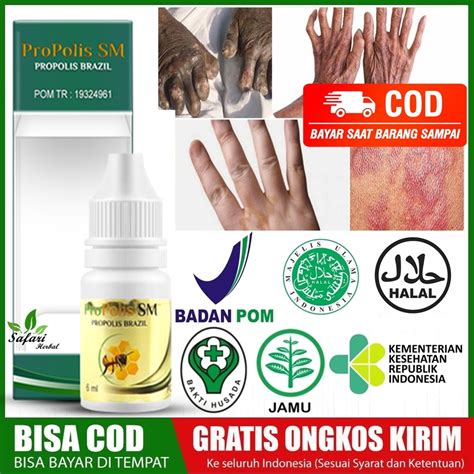 Jual Obat Kusta Lepra Kusta Kering Kusta Basah Obat Penyakit