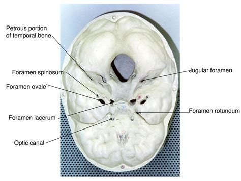 Foramen Rotundum And Ovale