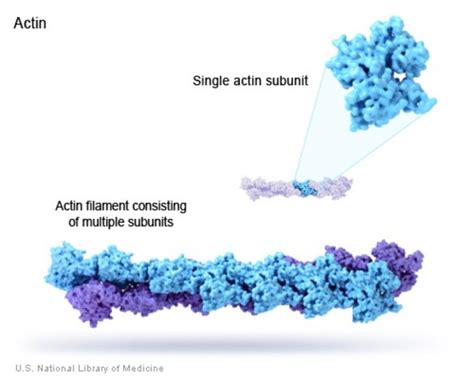 Larsen syndrome: MedlinePlus Genetics