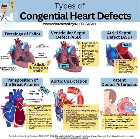 Types Of Congenital Heart Defects Medizzy