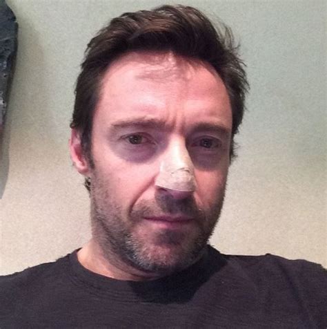 Hugh Jackman La Star De X Men Opérée Pour La Troisième Fois à Cause D