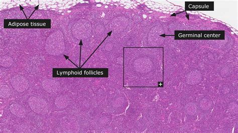 All About Lymph Node Follicles Lymph Nodes Medical School Motivation