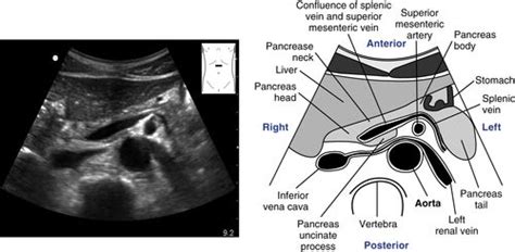 Abdominal Aorta Scanning Protocol Radiology Key