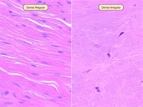 adipose tissue