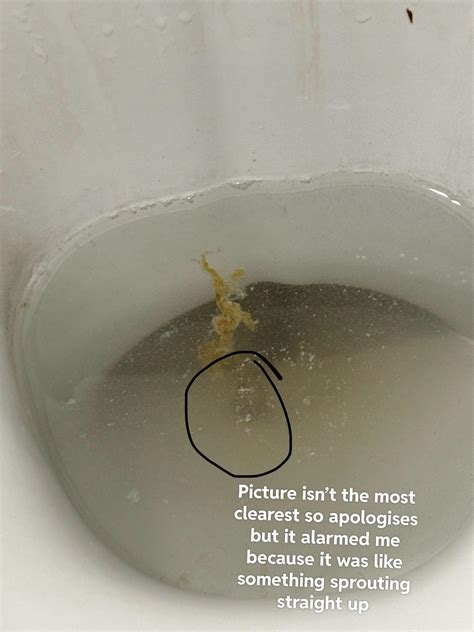 TW: faeces image. How do I fix my gut microbiome? : r/biofilms