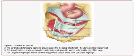 Central And Lateral Cystocele Iris Publishers