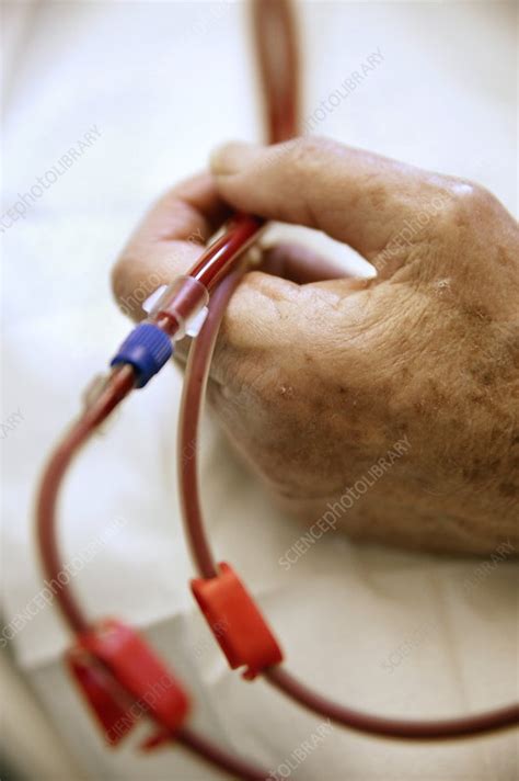 Kidney Dialysis Stock Image M4950106 Science Photo Library