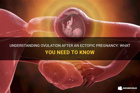 Understanding Ovulation After An Ectopic Pregnancy What You Need To