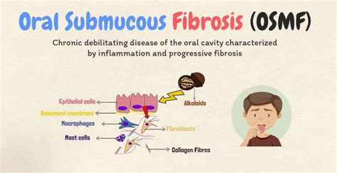 Oral Submucous Fibrosis Staging