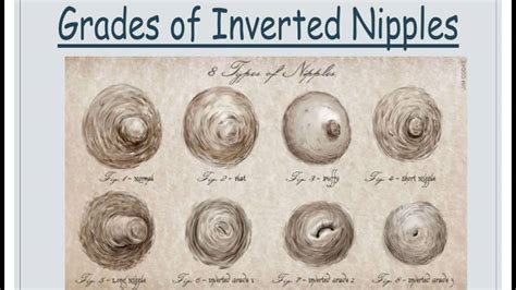 Premature Infant And Inverted Nipples Bcit Youtube