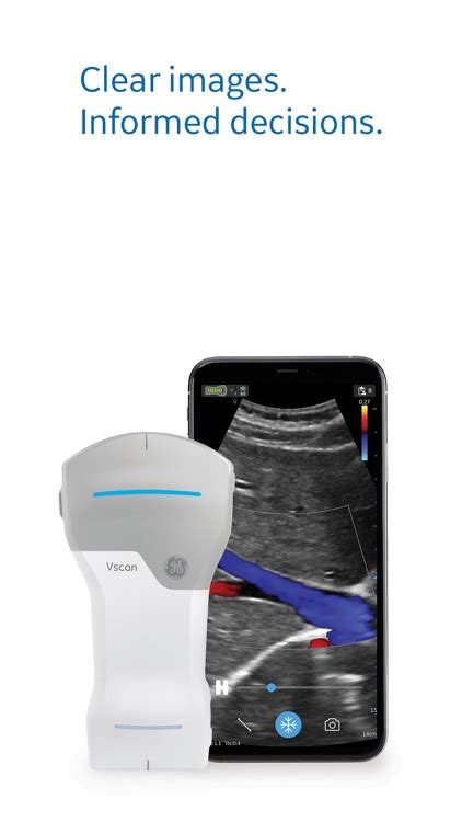 Vscan Air Wireless Ultrasound By Ge Healthcare