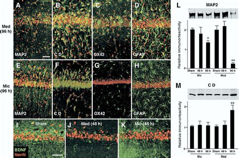 Figure 4 From The Intra Arterial Injection Of Microglia Protects