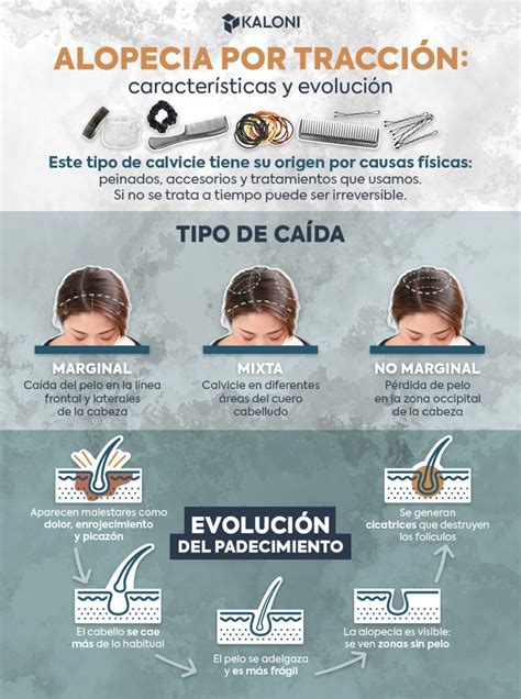 Alopecia Traccional Causas S Ntomas Y Tratamiento Kaloni Colombia