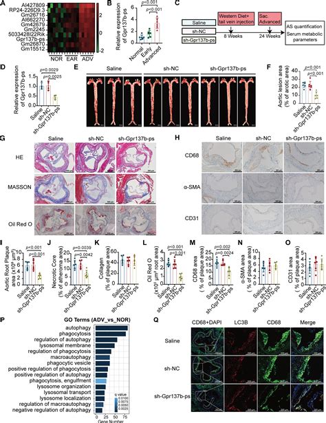 Long Noncoding Rna Gpr B Ps Promotes Advanced Atherosclerosis Via The