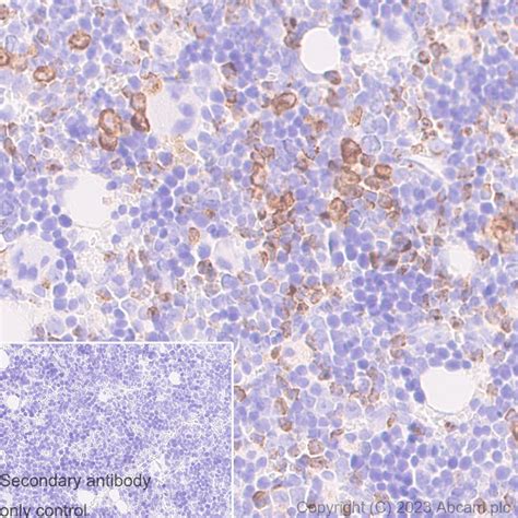 Neutrophil Elastase Rm Neutrophil Elastase Ab