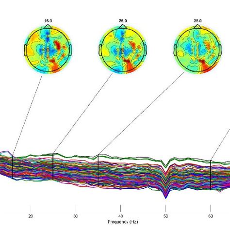 Power Spectral Density And Specific Topographical Maps Of Resting