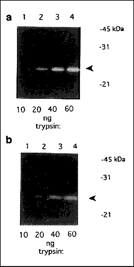 Figure 2 From Detection Of Proteolytic Activity By Fluorescent Zymogram