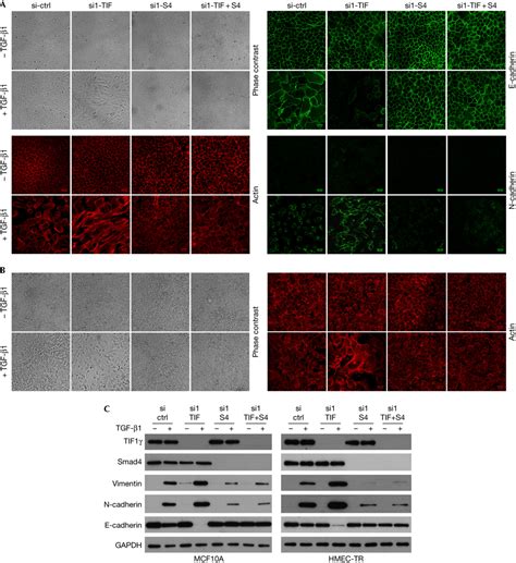 Antagonistic Regulation Of Emt By Tif And Smad In Mammary Epithelial