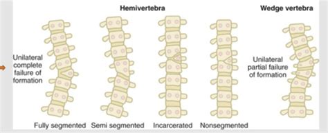 Clin Med MSK Exam 1 Flashcards Quizlet