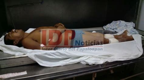 Muere Campesino Tras Accidente IDP Noticias