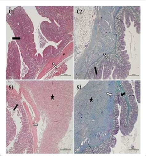 Histological Images Stained With Hematoxylineosin Left And Masson S