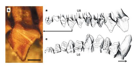 Lingual Surface Of The Right Upper Tooth Row And Buccal Surface Of The