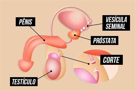 Vasectomia o que é como é feita e outras dúvidas comuns Tua Saúde