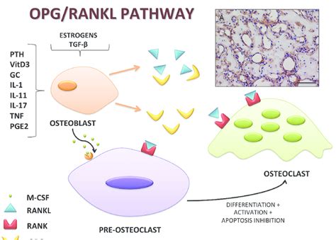 Opg Rankl Pathway In Bone Remodeling Osteoblasts Produce Rankl M Csf