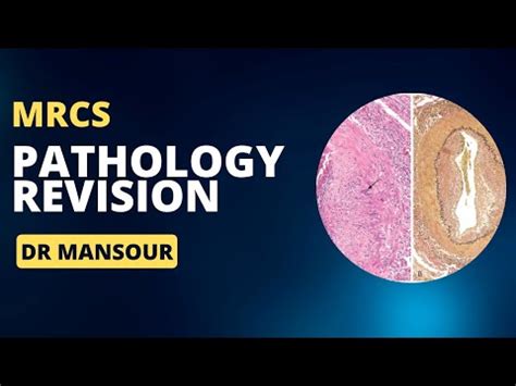 MRCS Part B Upper Limb Anatomy YouTube