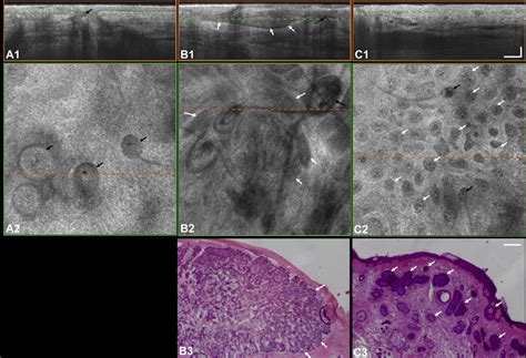 Gabor Domain Optical Coherence Microscopy GD OCM Cross Section