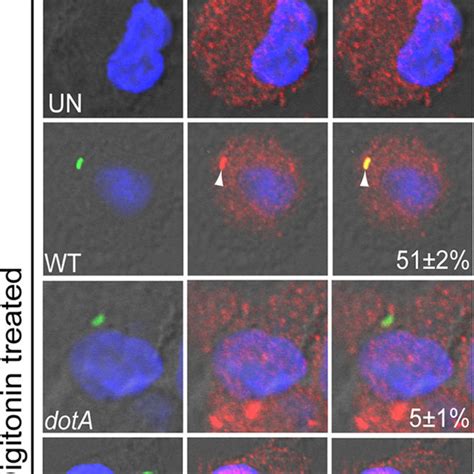 Anchoring Of Native Ankb Injected By Attached L Pneumophila To The