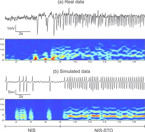 (a) Experimental LFP time series and associated spectrogram. (b) Model ... 