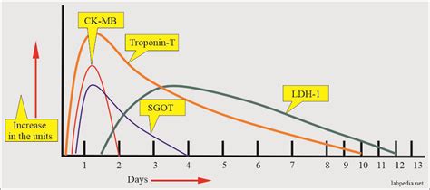 Cardiac Marker Part 3 Troponin T And Troponin I Labpedia Net