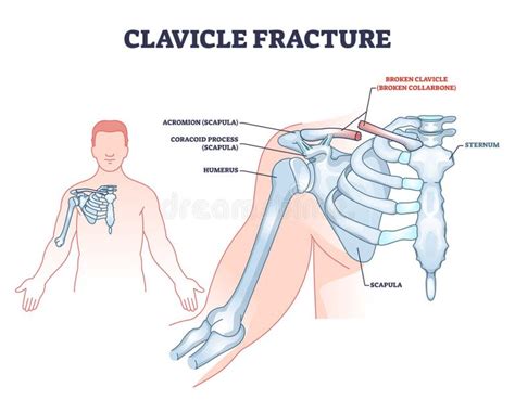 Anatomy Shoulder Joint Labeled Stock Illustrations 78 Anatomy Shoulder Joint Labeled Stock