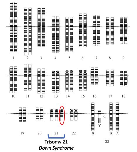 Chromosome Structure Changes Tutorial Sophia Learning