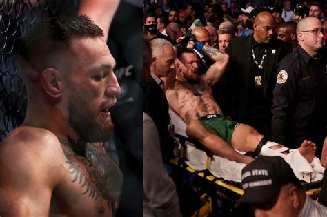 Photos From Conor Mcgregor S Leg Injury At Ufc 264