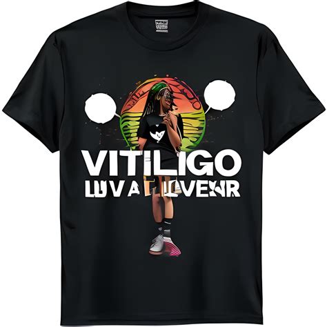 Bold Vitiligo Self Love T Shirt With Design And Unique Imperfections