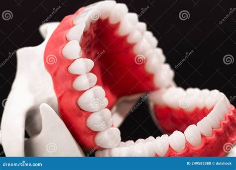 Human Jaw With Teeth And Gums Anatomy Model Isolated On Black