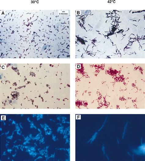 Acid Fast Stains Of Smeg After Growth At The Permissive And