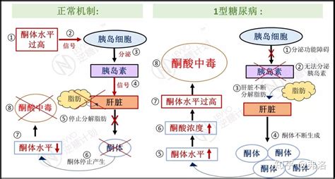 别再分不清营养性生酮和酮症酸中毒了！ 知乎