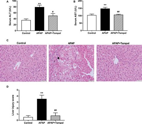 Frontiers Tempol Protects Against Acetaminophen Induced Acute