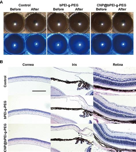 A Corneal Fluorescein Sodium Staining Images Before And After Drug Download Scientific