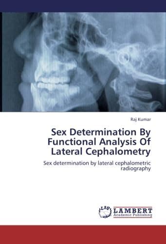 Sex Determination By Functional Analysis Of Lateral Cephalometry Sex Determination By Lateral