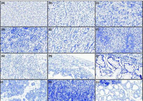 Figure S1 RNAscope In Situ Hybridization With DapB Negative Control