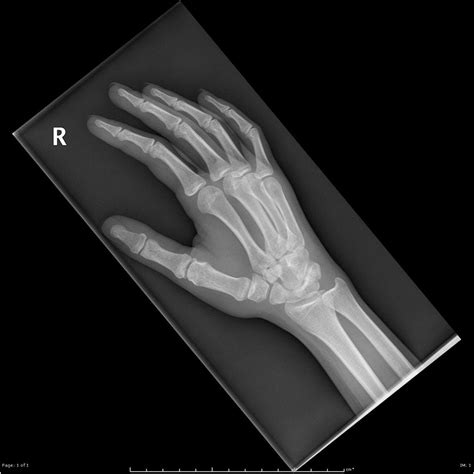 Hand Anatomy Xray - Anatomical Charts & Posters