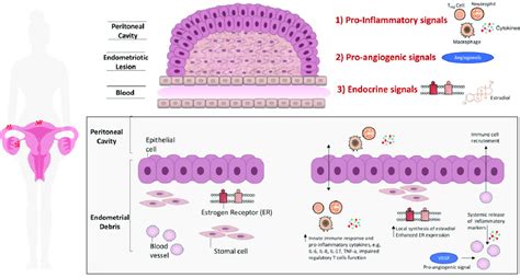 Molecular Pathways Underpinning Endometriosis Endometriotic Lesions